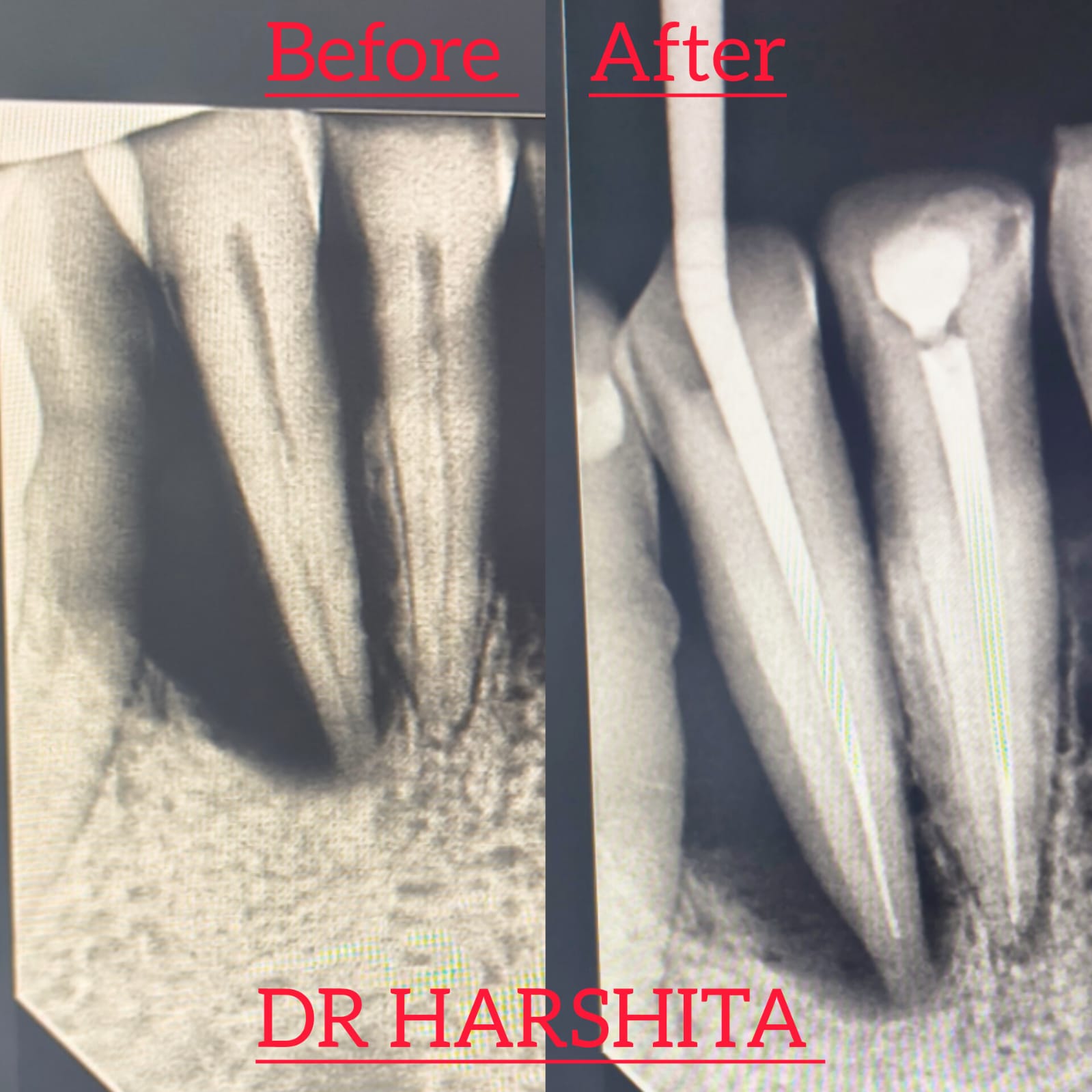 Before & After - Skin Treatment